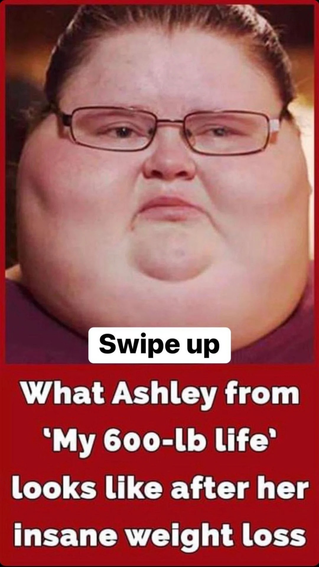 This is what Ashley Bratcher from ”My 600-Lb Life” looks like today