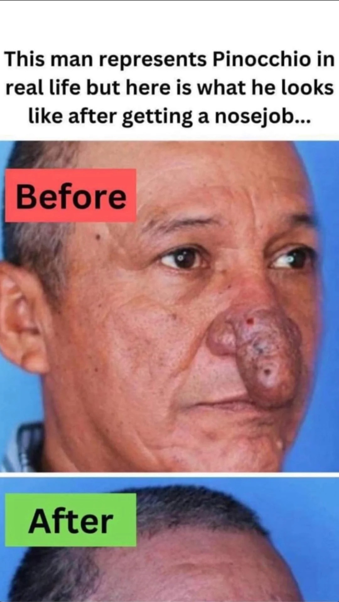 The Incredible Change in Conrado’s Nose