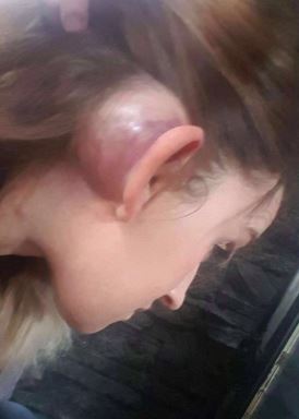  Fletcher beat Danielle so viciously she developed a tumour behind her ear