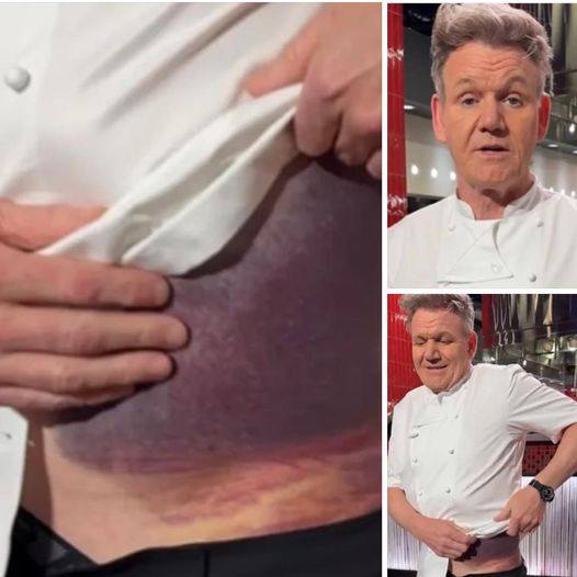 Gordon Ramsay shares important message after potentially fatal accident,m