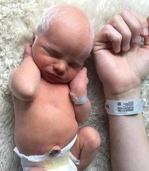 Baby mocked for having white hair – years later, he looks perfectly happy and healthy.